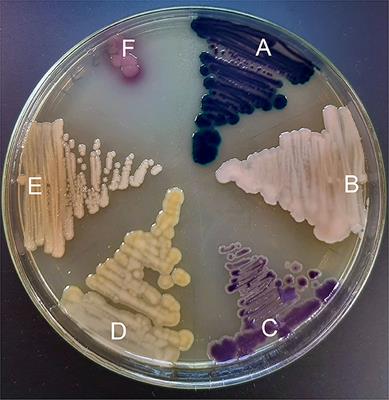 Polymyxin Resistant Bacteria in Australian Poultry